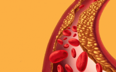 Biện pháp hỗ trợ kiểm soát mỡ máu an toàn