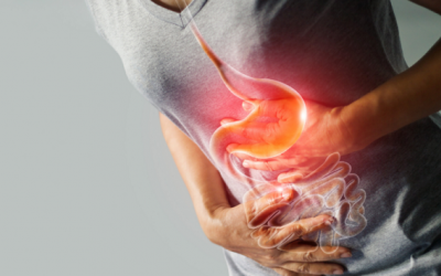 Dấu hiệu cảnh báo ung thư dạ dày