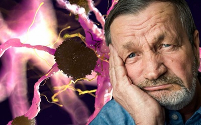 Người bệnh Parkinson và triệu chứng mất khả năng biểu cảm trên khuôn mặt