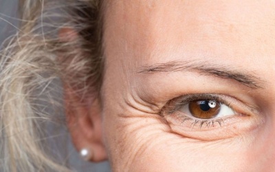 Chăm sóc da thế nào để ngăn ngừa vết chân chim?