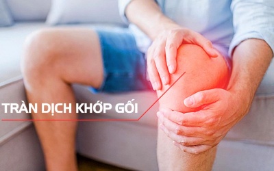 Thoái hóa khớp gối, có dịch đầu gối nên tập luyện thế nào?