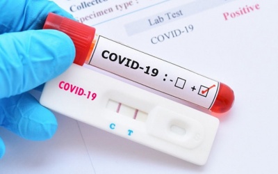 16 loại kit test nhanh COVID-19 được Bộ Y tế cấp phép và giá bán