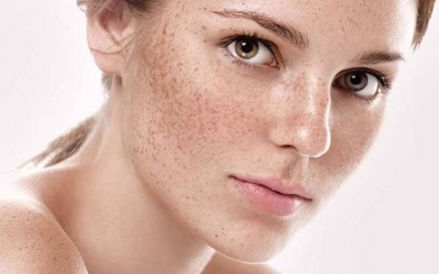 “Điểm mặt” những thói quen xấu gây nám da