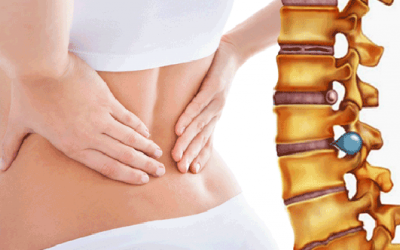 Thông tin về bệnh thoát vị đĩa đệm và giải pháp cải thiện từ thiên nhiên