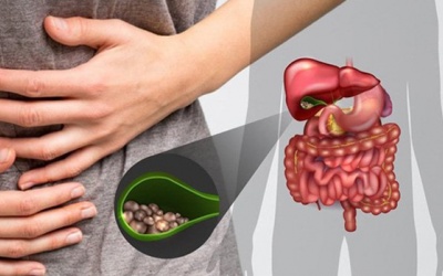 Cách phân biệt sỏi túi mật và sỏi ống mật chủ