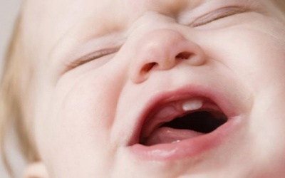 5 hiện tượng thường gặp khi trẻ bắt đầu mọc răng 