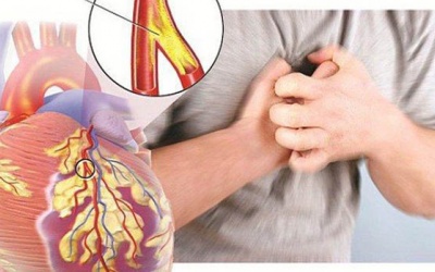 Biến chứng xơ vữa động mạch ở người mỡ máu cao