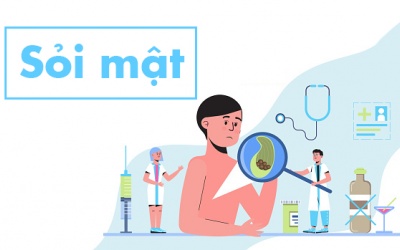 Tổng quan về sỏi mật: Nguyên nhân, triệu chứng và cách phòng ngừa 