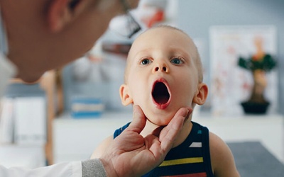 Bí quyết cải thiện viêm amidan ở trẻ tại nhà