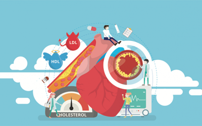 Chủ động tầm soát và dự phòng xơ vữa động mạch