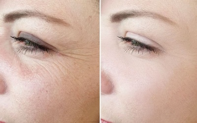 Những tư thế yoga giúp làm săn chắc vùng da quanh mắt 