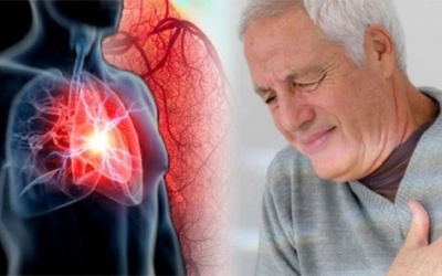 Xơ vữa động mạch vành gây ra những bệnh tim mạch nào?