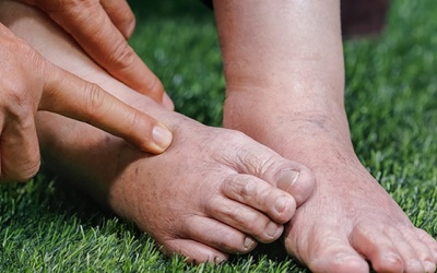 8 cách giúp giảm tình trạng giữ nước trong cơ thể