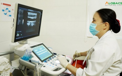 Siêu âm động mạch cảnh phát hiện sớm xơ vữa động mạch