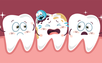 Tại sao bạn bị sâu răng và có chữa được không?