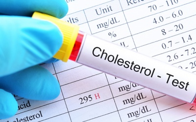 Những nguyên nhân gây ra tình trạng tăng cholesterol trong máu 