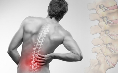 Cách cải thiện đau cột sống lưng hiệu quả cùng sản phẩm thiên nhiên