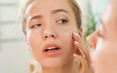 “Giải cứu” làn da trong mùa hanh khô