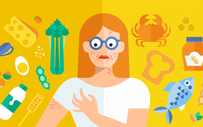 Dị ứng thực phẩm: Triệu chứng, kiểm soát thế nào?