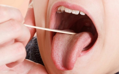 Tình trạng lưỡi tiết lộ điều gì về sức khỏe của bạn?