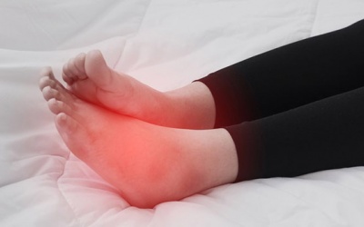 Tại sao bàn chân bị nóng rát khi đi bộ?