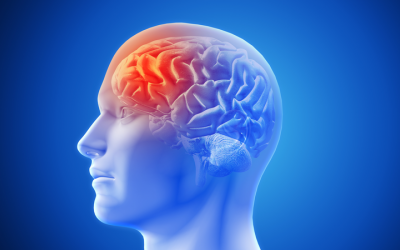 Chẩn đoán bệnh hẹp động mạch trong và ngoài sọ thế nào?