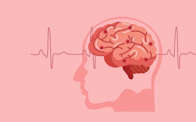 Ai dễ bị tai biến mạch máu não?