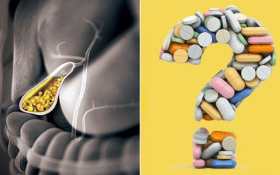 Người bị sỏi túi mật uống thuốc gì để tan sỏi?