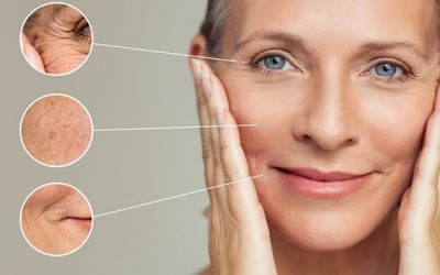 6 'thủ phạm' làm tăng nếp nhăn trên da của bạn