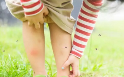 5 mùi hương giúp xua đuổi muỗi hiệu quả