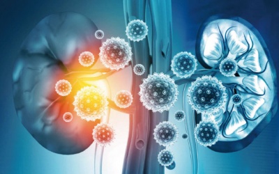 Phát hiện mới về mối liên hệ trực tiếp giữa bệnh suy thận và COVID-19