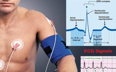 Vai trò của đo điện tâm đồ liên tục trong kiểm soát rối loạn nhịp tim?