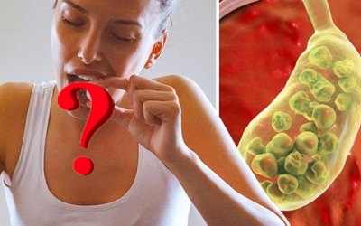 Ăn nhiều thực phẩm này làm trầm trọng cơn đau bụng do sỏi mật 