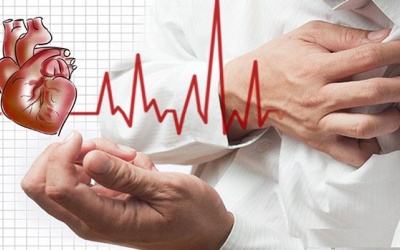 Những điều cần biết về bệnh nhồi máu cơ tim cấp