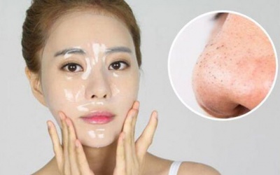 5 cách làm mặt nạ trị mụn đầu đen ngay tại nhà