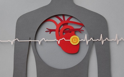 Đau tim thầm lặng nguy hiểm thế nào, có dấu hiệu cảnh báo không?