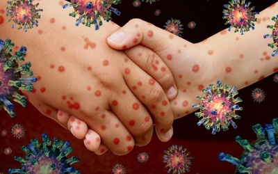 Bài học COVID: Giữ bàn tay sạch 