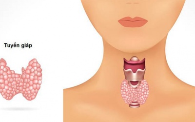 Bí kíp cải thiện nhân tuyến giáp bằng thảo dược