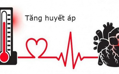 Tăng huyết áp: Những điều bạn cần biết