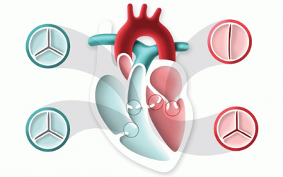 Đâu là van tim hay bị hẹp, hở và dạng nào nguy hiểm nhất?