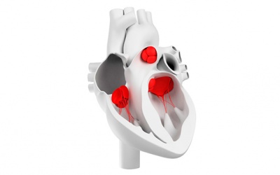 Mức độ và triệu chứng đặc trưng của các bệnh lý hẹp, hở van tim