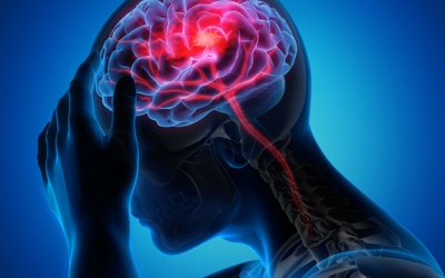 Coi chừng đột quỵ sau cơn thiếu máu não cục bộ thoáng qua