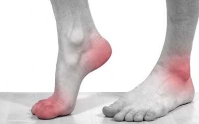 Tại sao trời lạnh cơn gout cấp lại “phát tác”?