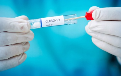 Không được lợi dụng tình hình dịch bệnh để tăng giá xét nghiệm COVID-19