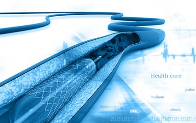Đặt stent điều trị thiếu máu cơ tim có thể gặp phải biến chứng gì?