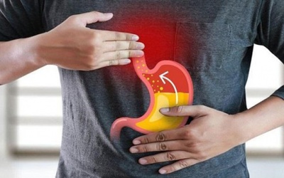 Trào ngược dạ dày thực quản và tim đập nhanh có liên hệ thế nào?
