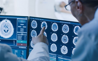 Bệnh Parkinson có chữa khỏi được không?