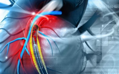 Các phương pháp chụp mạch vành chẩn đoán thiếu máu cơ tim và chi phí