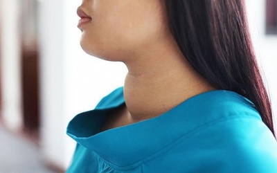 Bướu cổ: Nguyên nhân và cách khắc phục hiệu quả