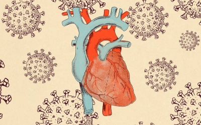 Di chứng tim mạch hậu COVID-19 do đâu, ai là người dễ mắc?